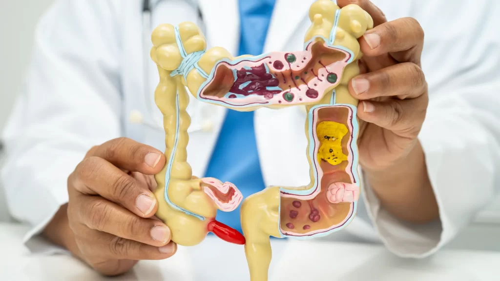 Foods that increase colon bloating